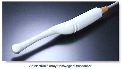 Transvaginal test look like the dildo - shaped transducer